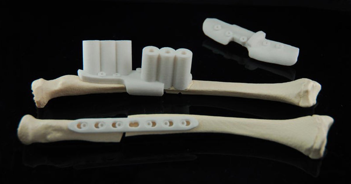 Knee Osteotomy アップデート Activmotion S - Plaques d'ostéotomies - Newclip Technics